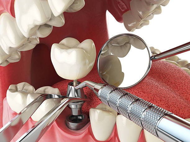 Best Walk-In Emergency Dentist in East Aurora, NY